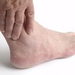 foot and ankle arthritis