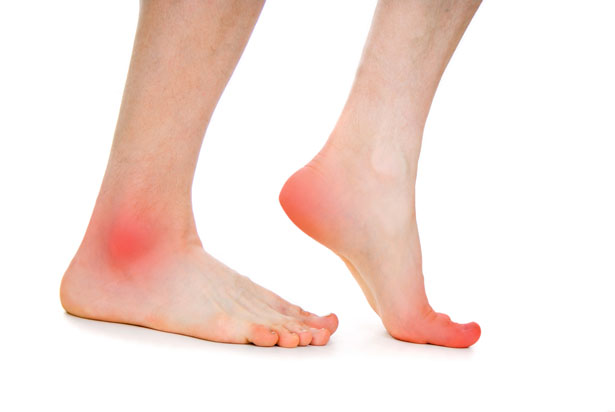 foot arthritis doctor