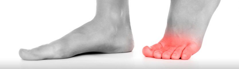 What Is Causing Your Toe Pain? | Achilles Podiatry